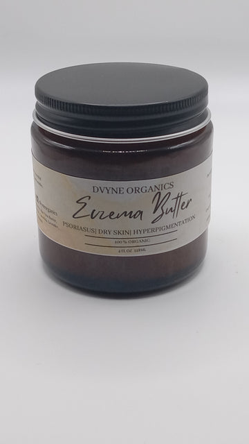 Eczema Butter